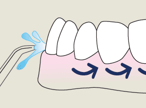 Move the flosser tip along the gums